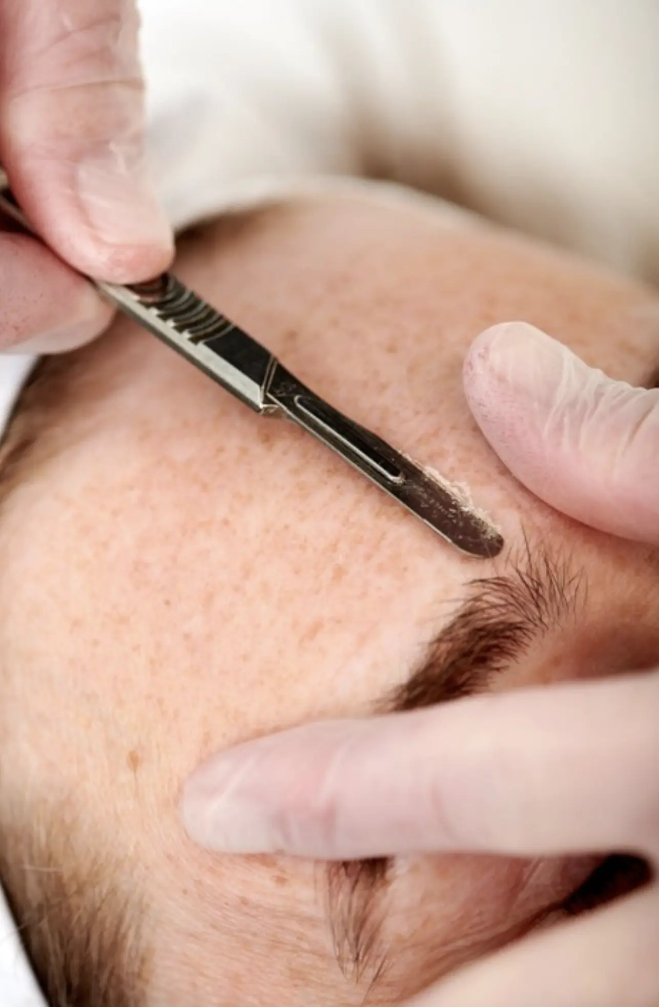 dermaplaning regrowth myth