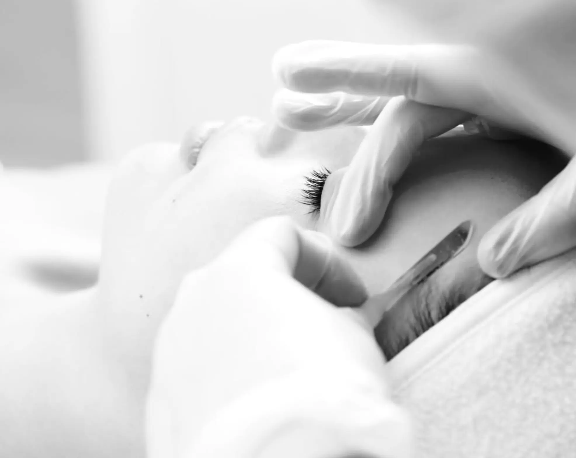 dermaplaning vs shaving