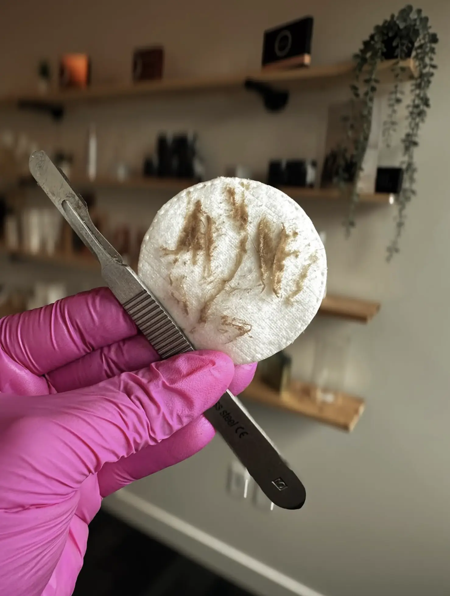vellus hair after dermaplaning