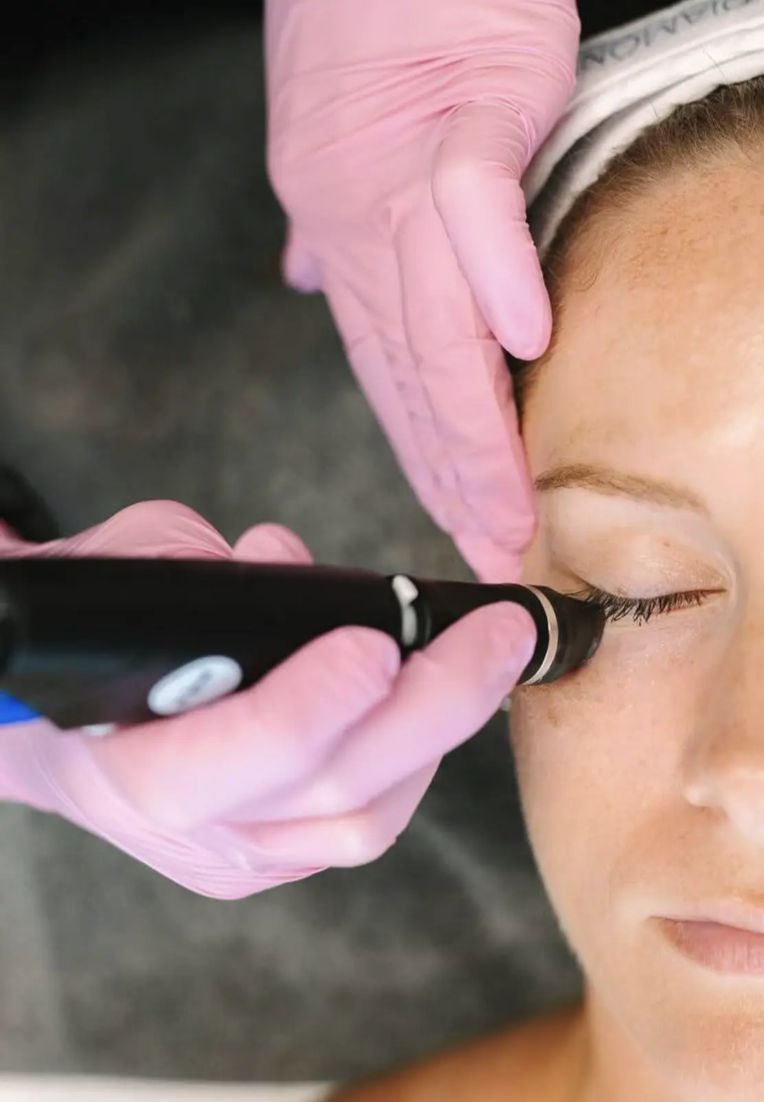 hydrafacial cbd