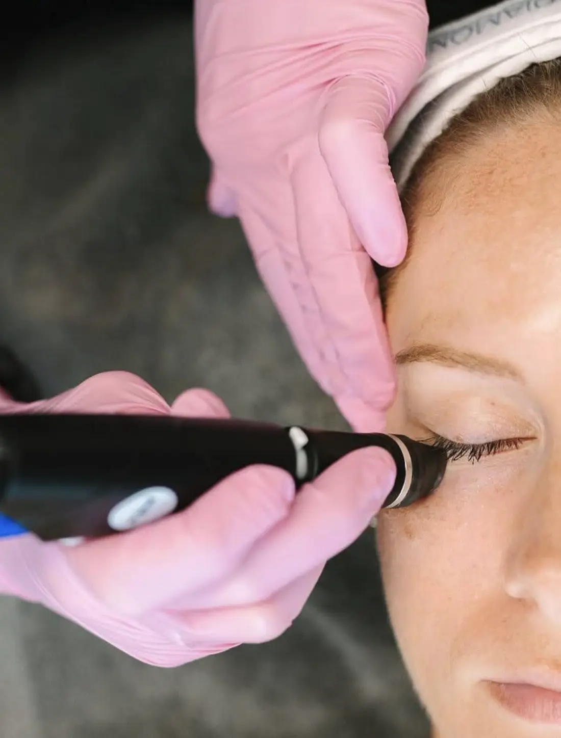 hydrafacial vs microdermabrasion
